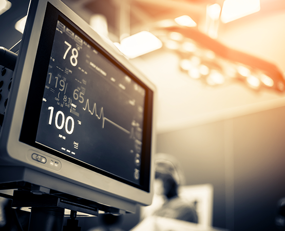 EKG